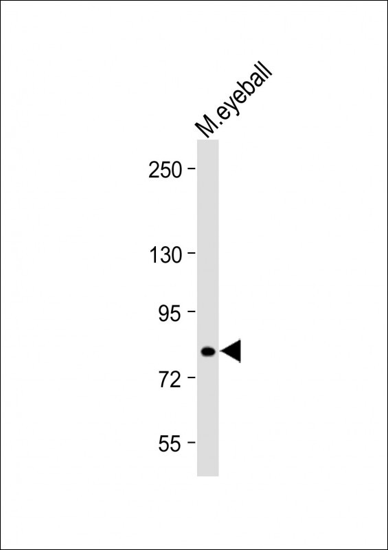 ABCB5 Antibody in Western Blot (WB)