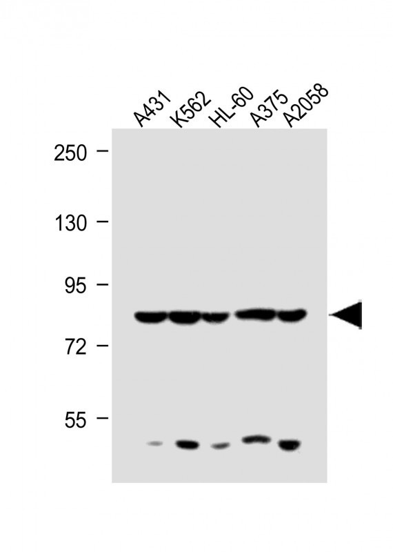 ABCB5 Antibody in Western Blot (WB)