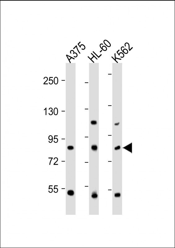 ABCB5 Antibody in Western Blot (WB)