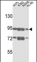 ABCB5 Antibody in Western Blot (WB)