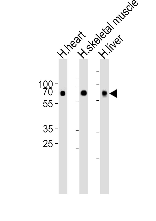 CRY2 Antibody in Western Blot (WB)