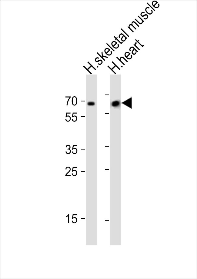 CRY2 Antibody in Western Blot (WB)