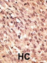 LRP5 Antibody in Immunohistochemistry (Paraffin) (IHC (P))