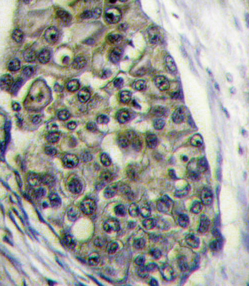 LRP6 Antibody in Immunohistochemistry (Paraffin) (IHC (P))