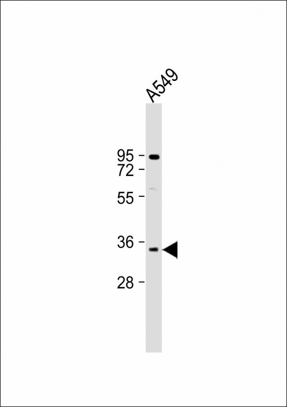 MAGEA2 Antibody in Western Blot (WB)