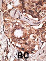 MAGEB2 Antibody in Immunohistochemistry (Paraffin) (IHC (P))