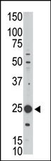 MAGEH1 Antibody in Western Blot (WB)