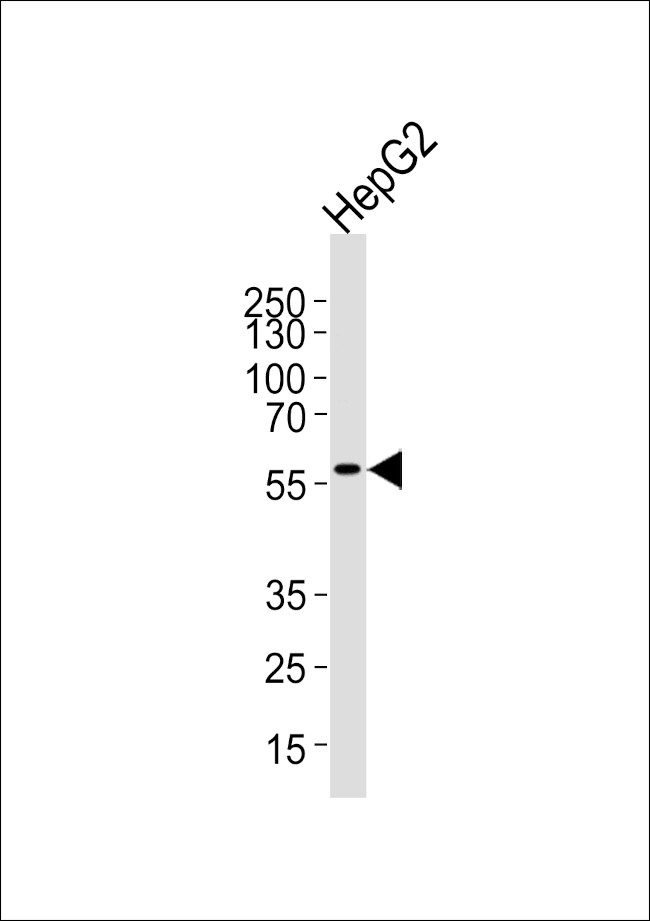 AF9 Antibody in Western Blot (WB)