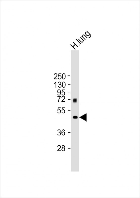 MMP12 Antibody in Western Blot (WB)