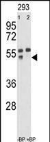 MMP12 Antibody in Western Blot (WB)