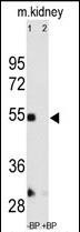 MMP12 Antibody in Western Blot (WB)