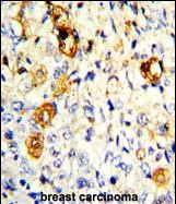 MMP19 Antibody in Immunohistochemistry (Paraffin) (IHC (P))