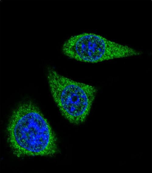 MMP7 Antibody in Immunocytochemistry (ICC/IF)