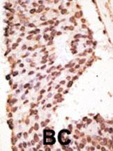 MMP7 Antibody in Immunohistochemistry (Paraffin) (IHC (P))