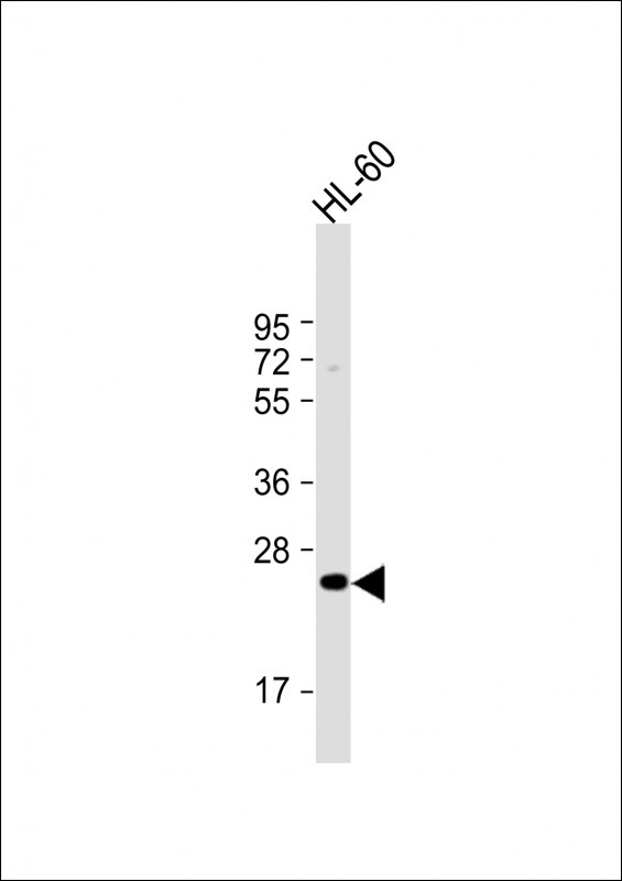 MMP7 Antibody in Western Blot (WB)