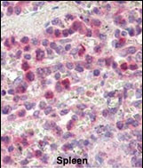 MMP9 Antibody in Immunohistochemistry (Paraffin) (IHC (P))