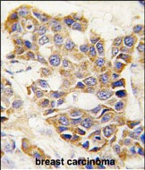 MMP9 Antibody in Immunohistochemistry (Paraffin) (IHC (P))