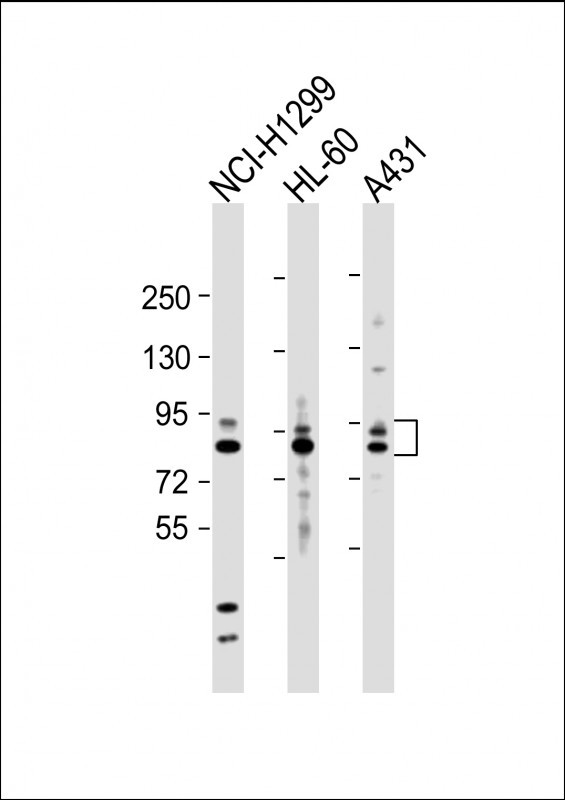 MMP9 Antibody in Western Blot (WB)