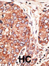 Septin-9 Antibody in Immunohistochemistry (Paraffin) (IHC (P))