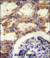 Septin-9 Antibody in Immunohistochemistry (Paraffin) (IHC (P))