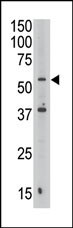 Septin-9 Antibody in Western Blot (WB)