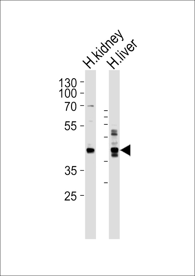 Septin-9 Antibody in Western Blot (WB)