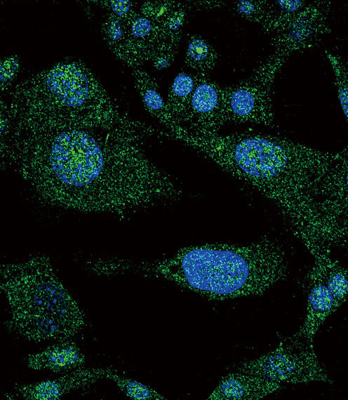 NOTCH3 Antibody in Immunocytochemistry (ICC/IF)