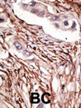 NOTCH3 Antibody in Immunohistochemistry (Paraffin) (IHC (P))