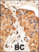 NRG1 Antibody in Immunohistochemistry (Paraffin) (IHC (P))