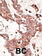 SIRT3 Antibody in Immunohistochemistry (Paraffin) (IHC (P))