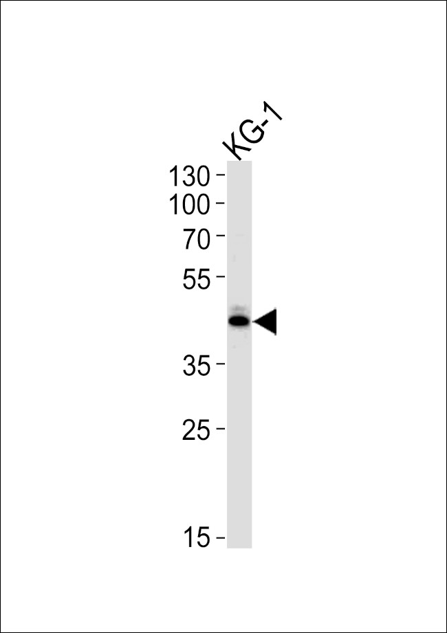 SIRT3 Antibody in Western Blot (WB)