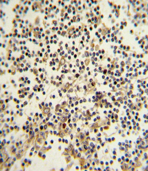 CD82 Antibody in Immunohistochemistry (Paraffin) (IHC (P))