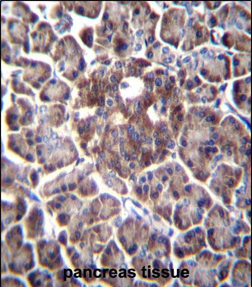 DDIT4 Antibody in Immunohistochemistry (Paraffin) (IHC (P))