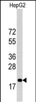 p27 Kip1 Antibody in Western Blot (WB)