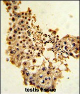 Cyclin E Antibody in Immunohistochemistry (Paraffin) (IHC (P))