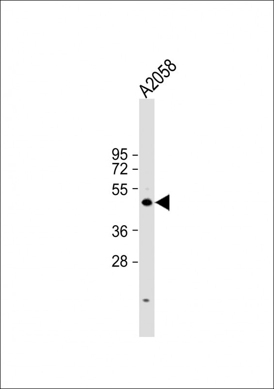 Cyclin E Antibody in Western Blot (WB)