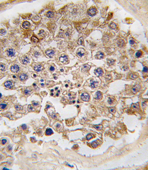 mTOR Antibody in Immunohistochemistry (Paraffin) (IHC (P))