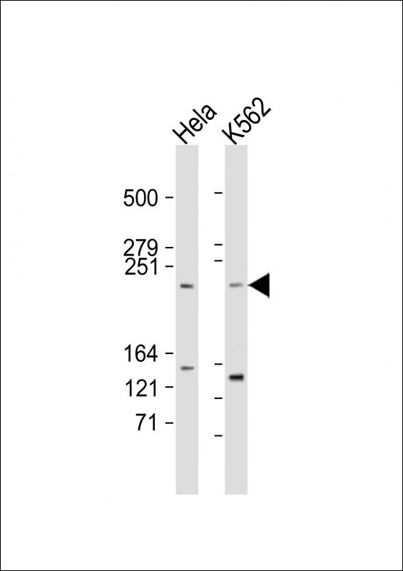 mTOR Antibody in Western Blot (WB)