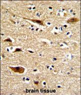 Amyloid Precursor Protein Antibody in Immunohistochemistry (Paraffin) (IHC (P))