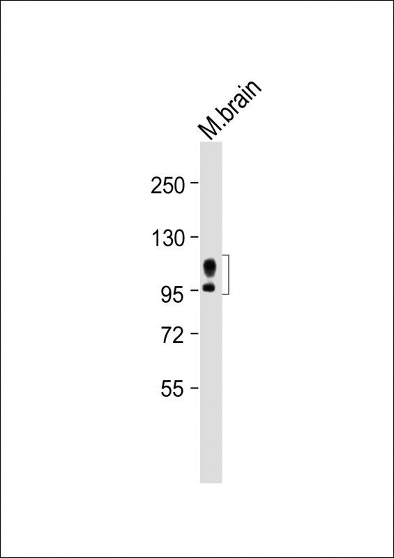 Amyloid Precursor Protein Antibody in Western Blot (WB)