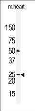 Claudin 2 Antibody in Western Blot (WB)