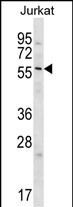 Glypican 3 Antibody in Western Blot (WB)