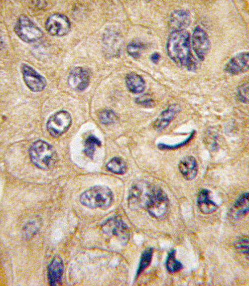 TSC2 Antibody in Immunohistochemistry (Paraffin) (IHC (P))