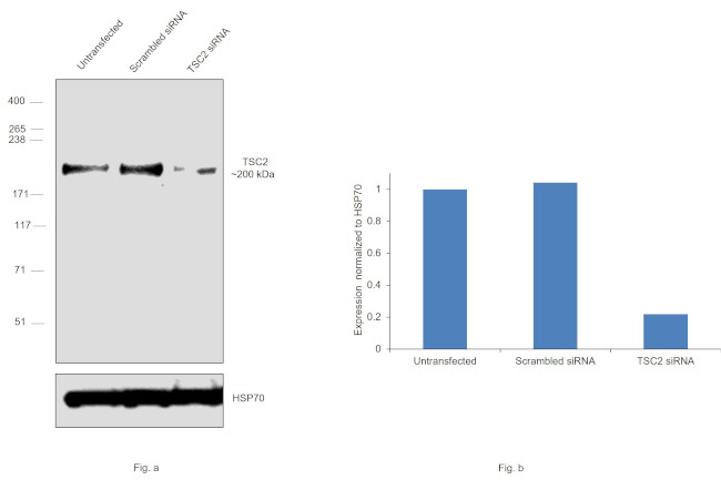 TSC2 Antibody