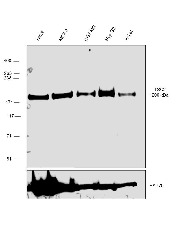 TSC2 Antibody in Western Blot (WB)