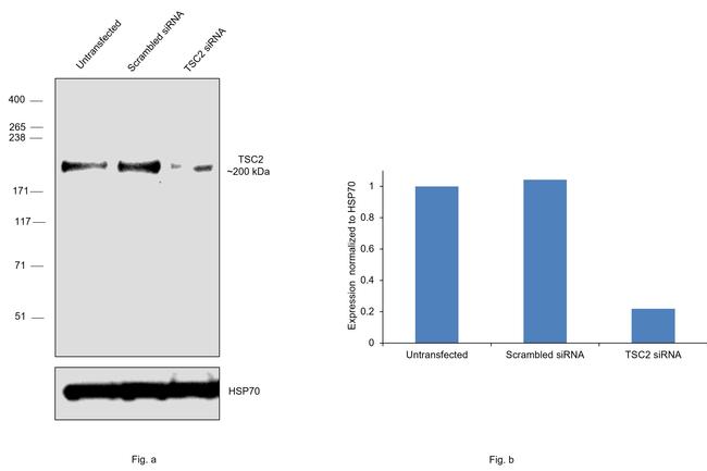 TSC2 Antibody in Western Blot (WB)