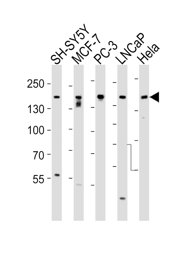 TSC2 Antibody in Western Blot (WB)