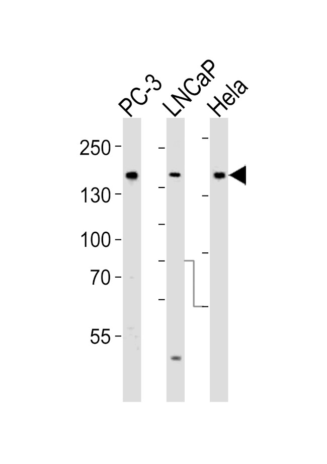 TSC2 Antibody in Western Blot (WB)