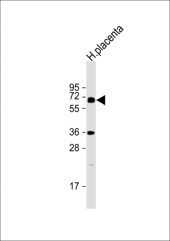 IL1R1 Antibody in Western Blot (WB)