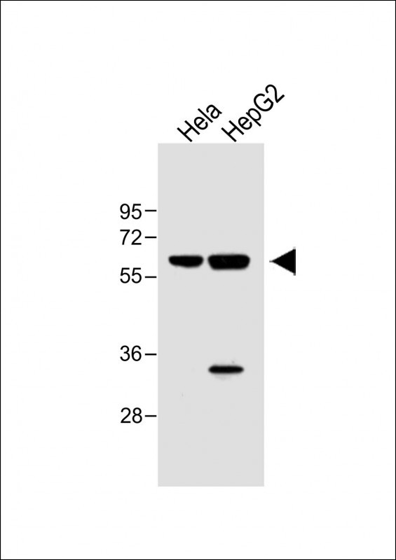 IL1R1 Antibody in Western Blot (WB)